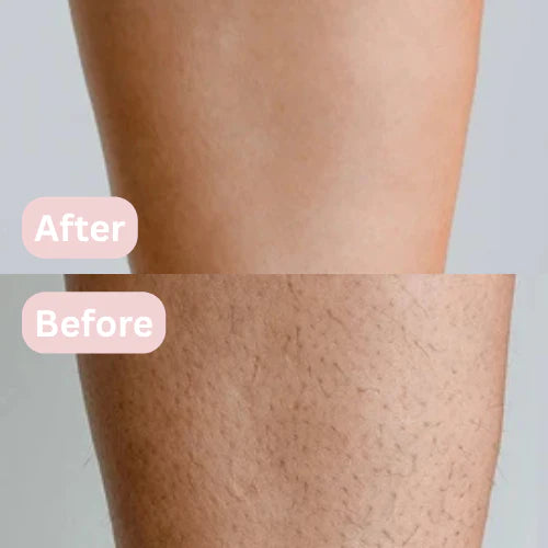 InstantGlow™ SilkTouch — Smooth Skin, Zero Irritation